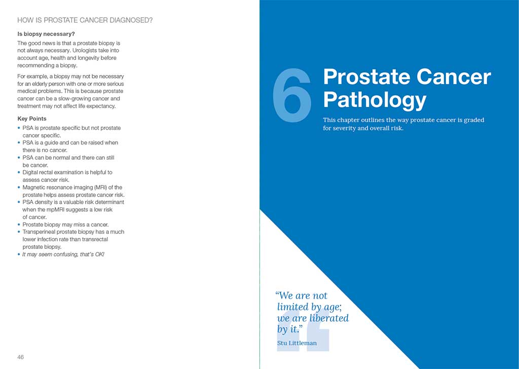 thesis on prostate cancer